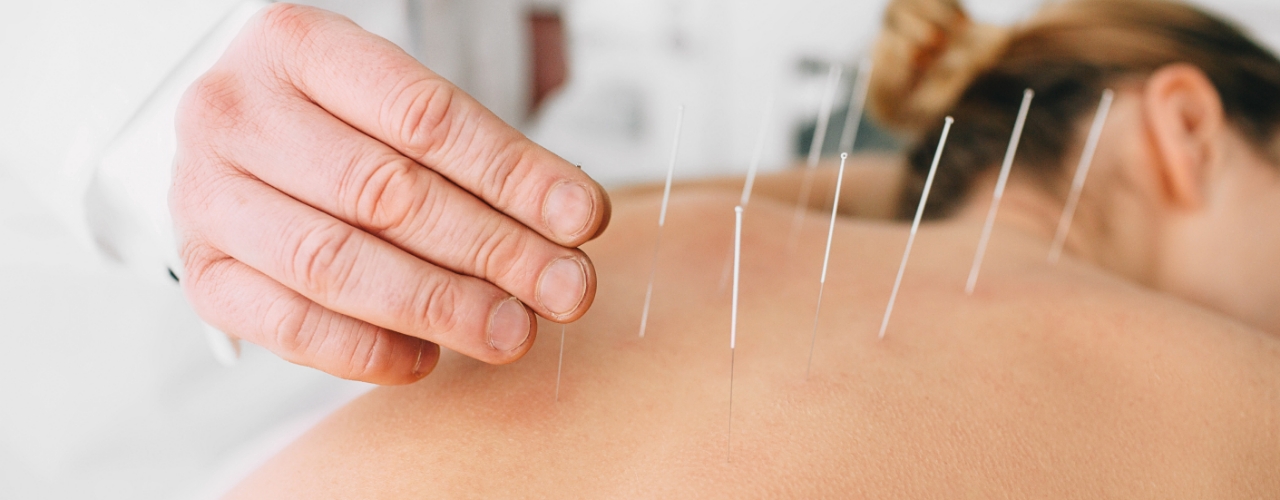 Acupuncture-Stonegate-Physiotherapy-and-Massage-Clinic-Airdrie-AB