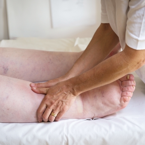 Lymphedema-Stonegate-Physiotherapy-and-Massage-Clinic-Airdrie-AB